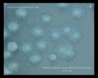 proteus mirabilis on CLED